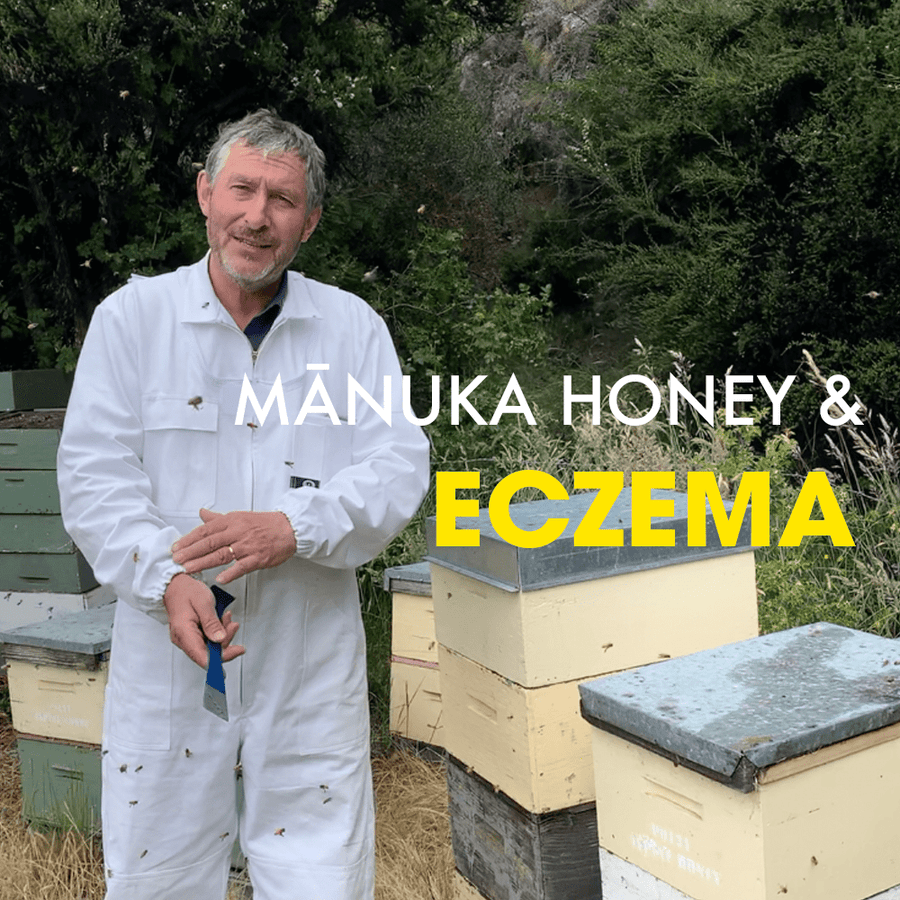 Manuka Honey when used for Eczema